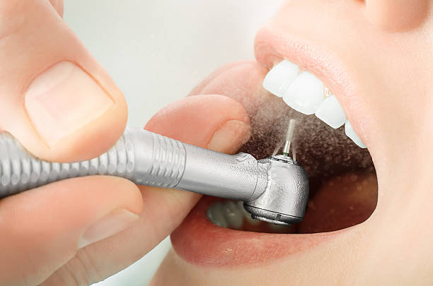 a close-up shot of teeth receiving professional dental cleaning
